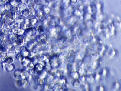 bubble cell image